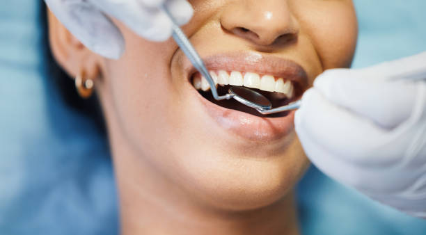 Best Emergency Dental Care for Sports Injuries in Vista Santa Rosa, CA